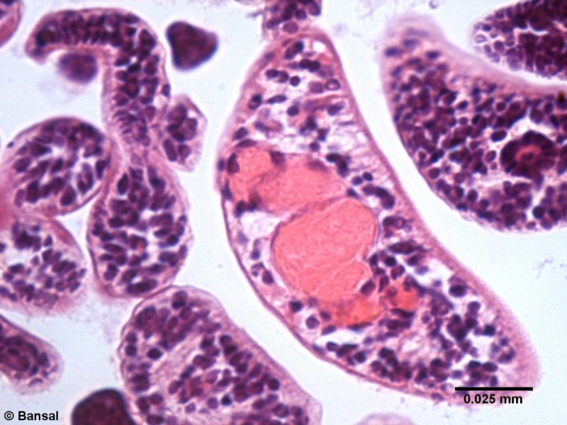 trem103p.jpg trem103p.jpg