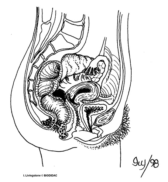 humn145b.gif